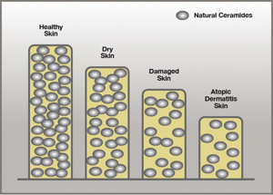 ceramide-peristomal-skin-ostomy-illustration
