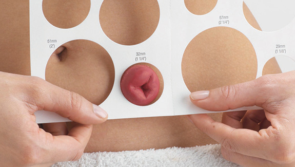 woman-measuring-her-stoma-with-Hollister-stoma-measuring-guide-575x325