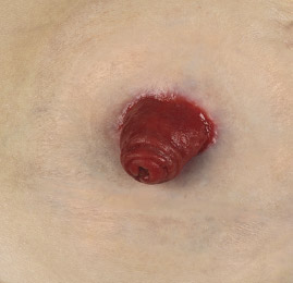 healthy-peristomal-skin