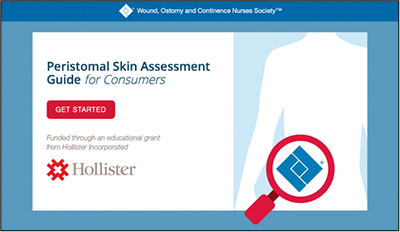 Peristomal_skin_assessment_400x232