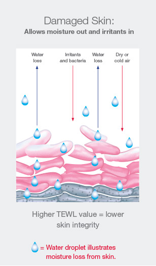 unhealthy-skin-308x525