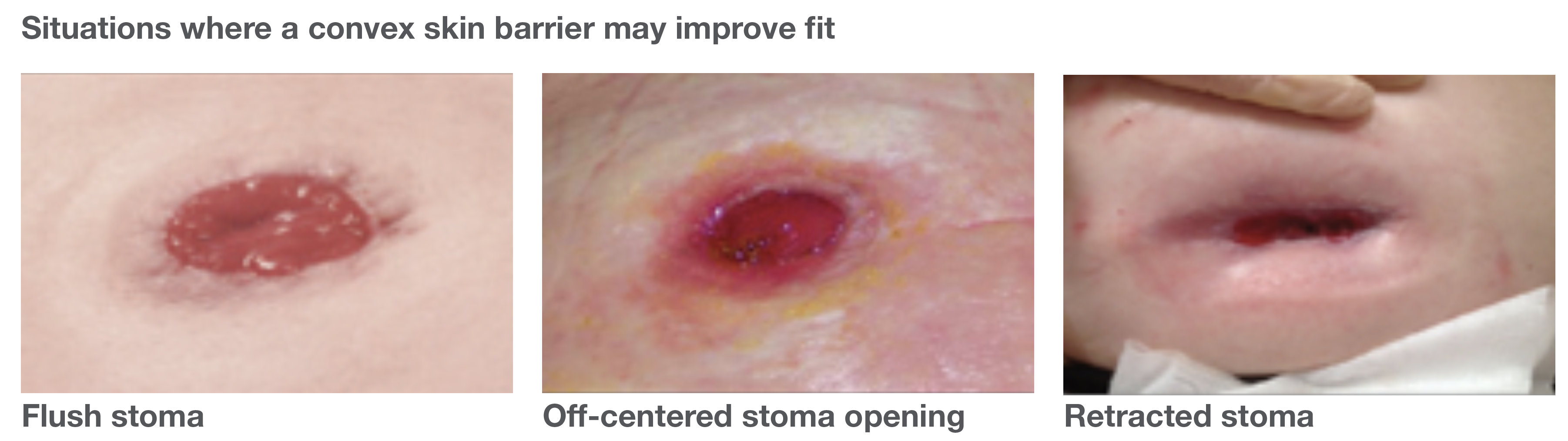 Secure Start Newsletter Hollister US