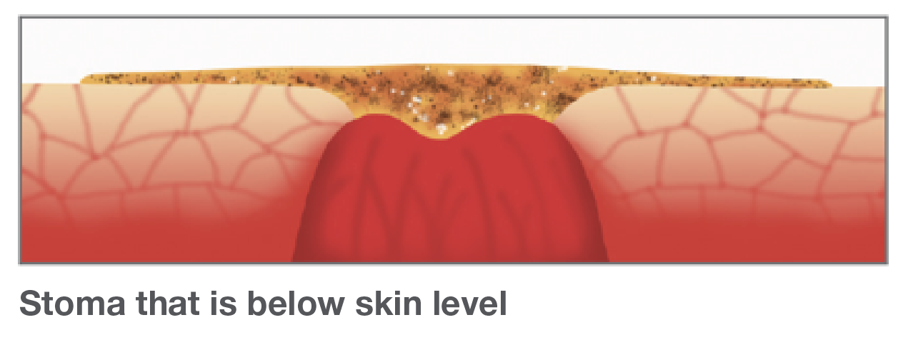 article-2018-q4-get3
