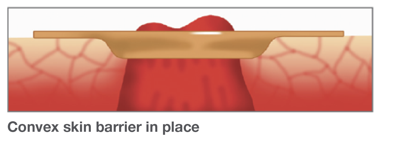article-2018-q4-get4